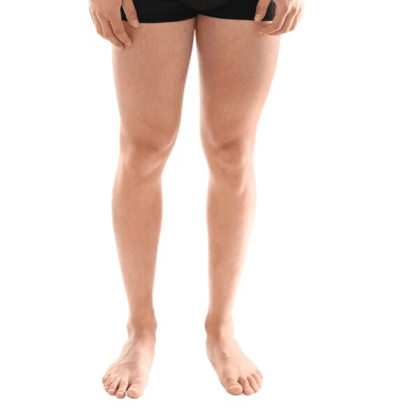 Full Legs (incl Feet & Toes) - Medical Aesthetic